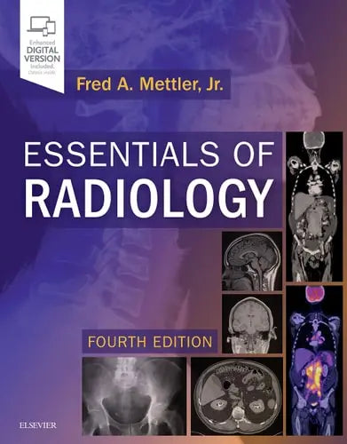 Essentials of Radiology Elsevier