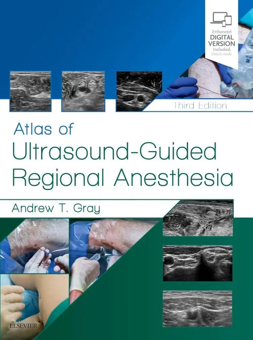 Atlas of Ultrasound-guided Regional Anesthesia by Andrew T. Gray