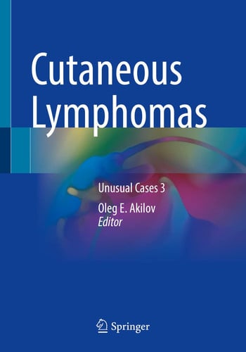Cutaneous Lymphomas Unusual Cases 3 by Oleg E. Akilov – book cover