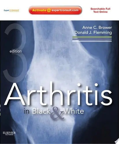 Arthritis in Black and White Expert Consult - Online and Print Elsevier Health Sciences