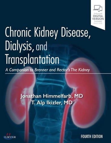 Chronic Kidney Disease, Dialysis, and Transplantation A Companion to Brenner and Rector's the Kidney by Jonathan Himmelfarb – book cover