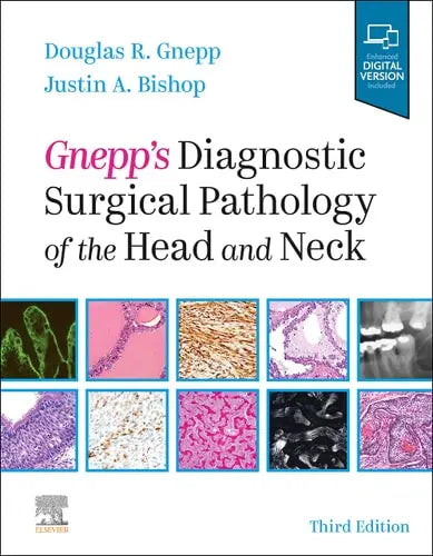 Gnepp's Diagnostic Surgical Pathology of the Head and Neck Elsevier