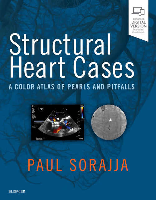 Structural Heart Cases A Color Atlas of Pearls and Pitfalls by Paul Sorajja