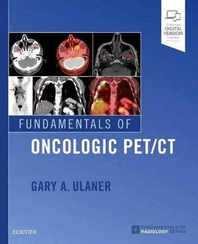 Fundamentals of Oncologic PET/CT Elsevier