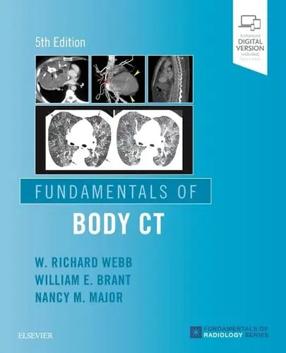 Fundamentals of Body CT Elsevier
