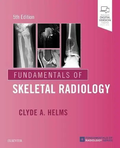 Fundamentals of Skeletal Radiology Elsevier