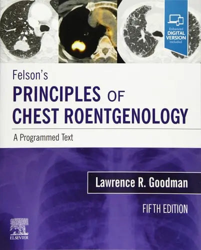 Felson's Principles of Chest Roentgenology A Programmed Text Elsevier