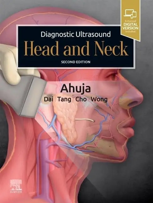 Diagnostic Ultrasound: Head and Neck by Anil T. Ahuja