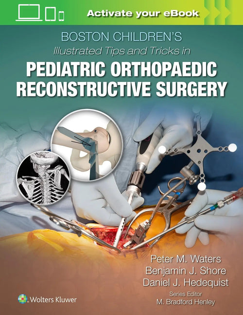 Boston Children's Illustrated Tips and Tricks in Pediatric Orthopaedic Reconstructive Surgery by Peter M. Waters