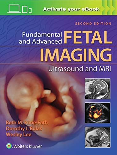 Fundamental and Advanced Fetal Imaging Ultrasound and MRI Lippincott Williams & Wilkins