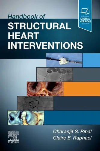 Handbook of Structural Heart Interventions Elsevier - Health Sciences Division