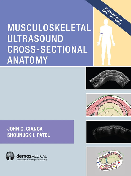 Musculoskeletal Ultrasound Cross Sectional Anatomy by John C. Cianca