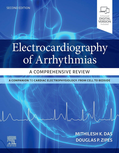 Electrocardiography of Arrhythmias A Comprehensive Review by Mithilesh Kumar Das