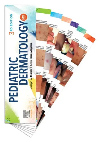 Pediatric Dermatology DDX Deck Elsevier - Health Sciences Division