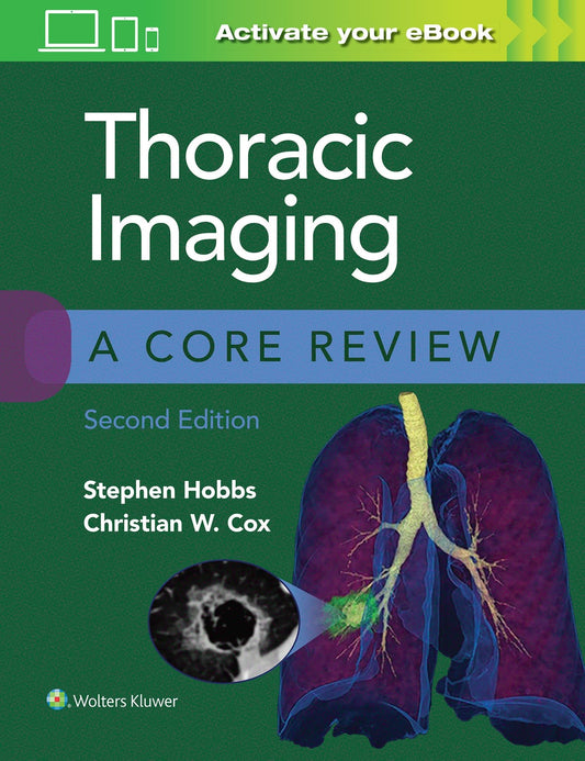 Thoracic Imaging A Core Review by Stephen B. Hobbs – book cover