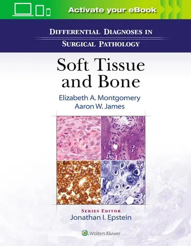 Differential Diagnoses in Surgical Pathology: Soft Tissue and Bone Wolters Kluwer