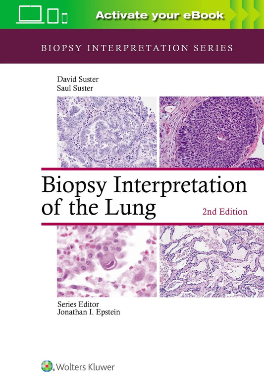 Biopsy Interpretation of the Lung by Saul Suster – book cover