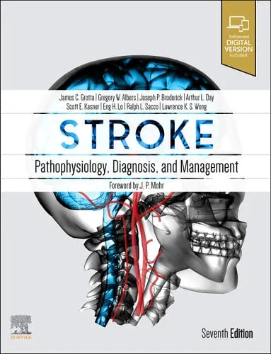 Stroke Pathophysiology, Diagnosis, and Management Elsevier