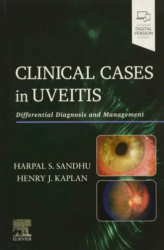 Clinical Cases in Uveitis Differential Diagnosis and Management Elsevier