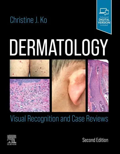 Dermatology Visual Recognition and Case Reviews Elsevier