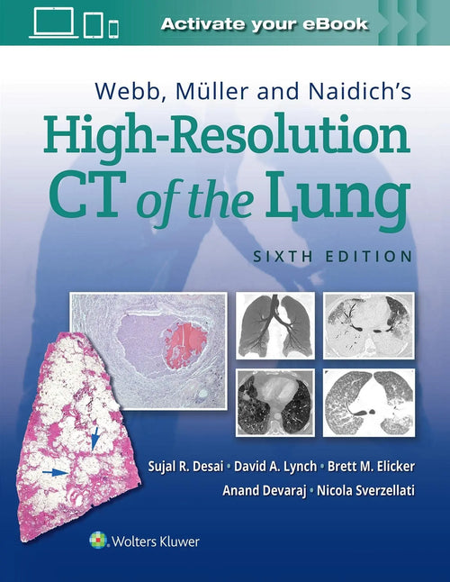 Webb, Müller and Naidich's High-Resolution CT of the Lung by Sujal Desai