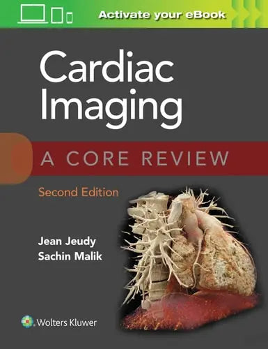 Cardiac Imaging A Core Review Lippincott Williams & Wilkins