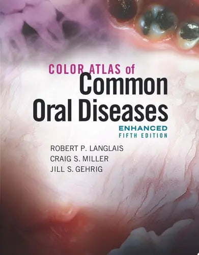 Color Atlas of Common Oral Diseases, Enhanced Edition Jones & Bartlett Learning