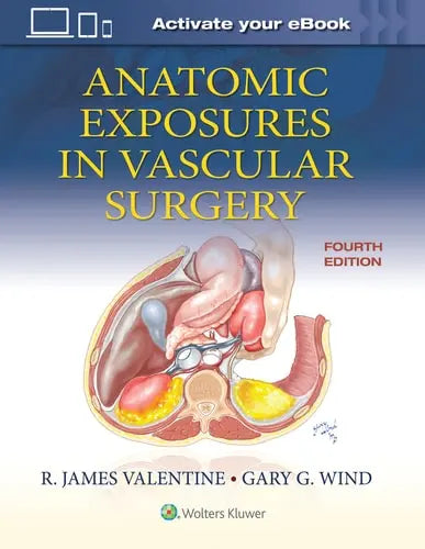 Anatomic Exposures in Vascular Surgery Lippincott Williams & Wilkins