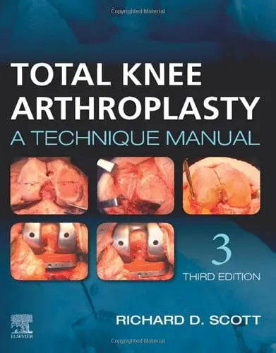 Total Knee Arthroplasty A Technique Manual Elsevier