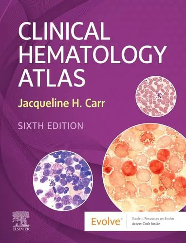 Clinical Hematology Atlas Elsevier