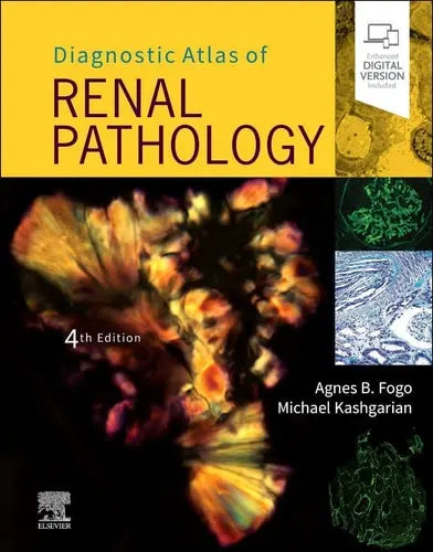 Diagnostic Atlas of Renal Pathology Elsevier