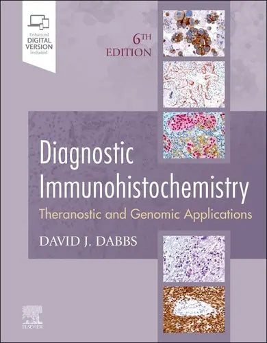 Diagnostic Immunohistochemistry Theranostic and Genomic Applications Elsevier