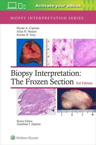 Biopsy Interpretation The Frozen Section Lippincott Williams & Wilkins