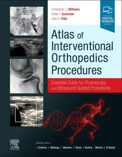 Atlas of Interventional Orthopedics Procedures Essential Guide for Fluoroscopy and Ultrasound Guided Procedures Elsevier