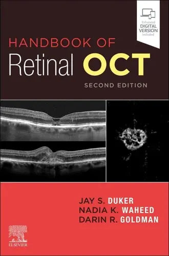 Handbook of Retinal OCT: Optical Coherence Tomography Elsevier