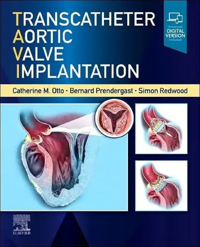 Transcatheter Aortic Valve Implantation Elsevier Health Sciences