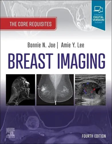 Breast Imaging The Core Requisites Elsevier