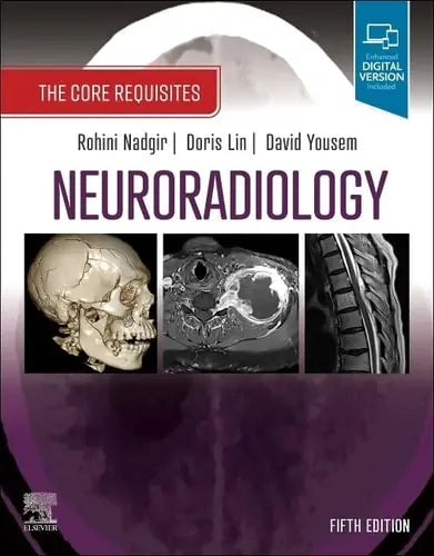 Neuroradiology The Core Requisites Elsevier