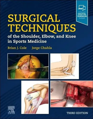 Surgical Techniques of the Shoulder, Elbow, and Knee in Sports Medicine Elsevier