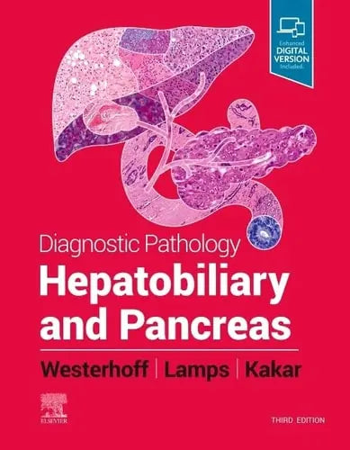 Diagnostic Pathology : Hepatobiliary and Pancreas Elsevier