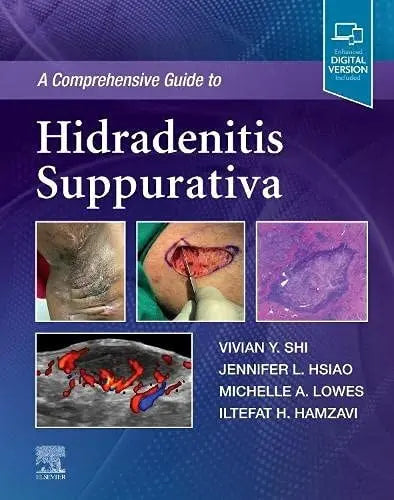 A Comprehensive Guide to Hidradenitis Suppurativa Elsevier - Health Sciences Division