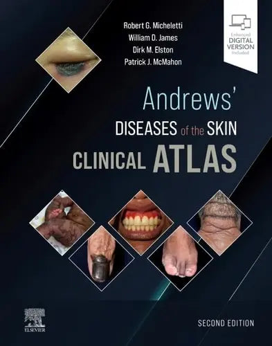 Andrews' Diseases of the Skin Clinical Atlas Elsevier