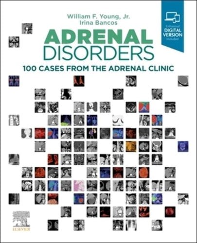 Adrenal Disorders 100 Cases from the Adrenal Clinic