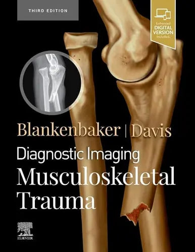 Diagnostic Imaging: Musculoskeletal Trauma Elsevier