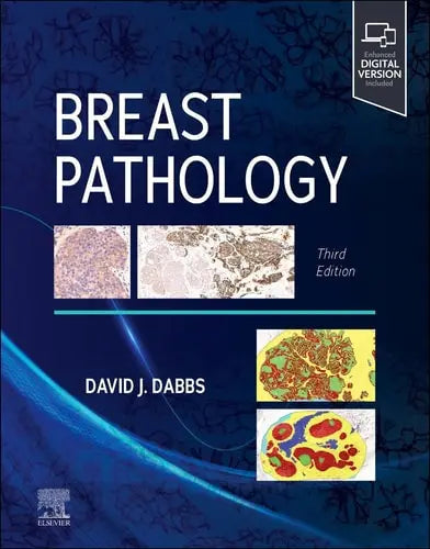Breast Pathology Elsevier