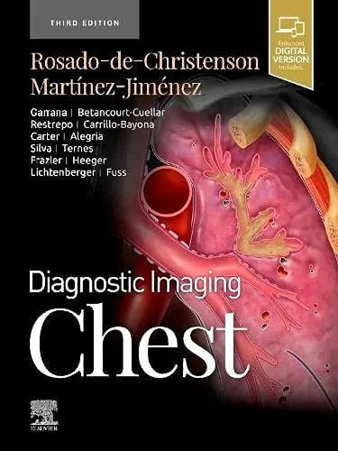 Diagnostic Imaging: Chest Elsevier