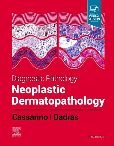 Diagnostic Pathology: Neoplastic Dermatopathology Elsevier