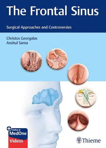 The Frontal Sinus Surgical Approaches and Controversies Thieme