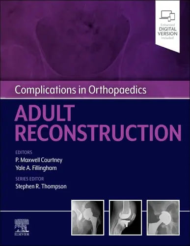 Complications in Orthopaedics: Adult Reconstruction by Paul Maxwell Courtney