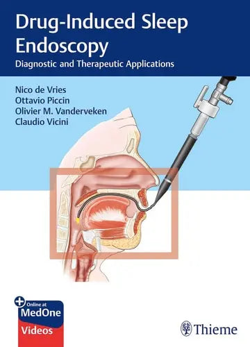 Drug-Induced Sleep Endoscopy Diagnostic and Therapeutic Applications Wolters Kluwer.